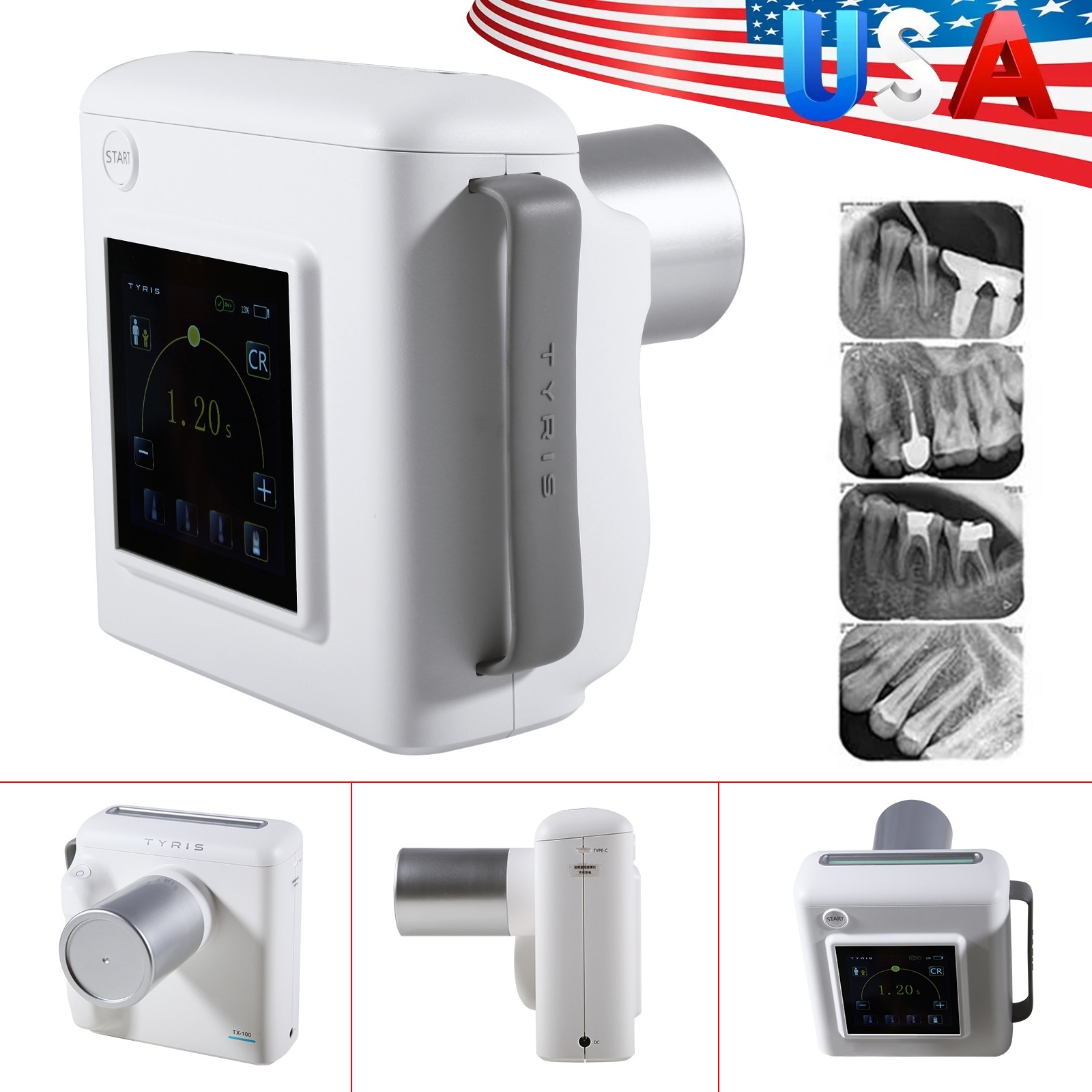 Dental Portable X Mobile Ray Machine Unit Digital High Frequency no Shield USA