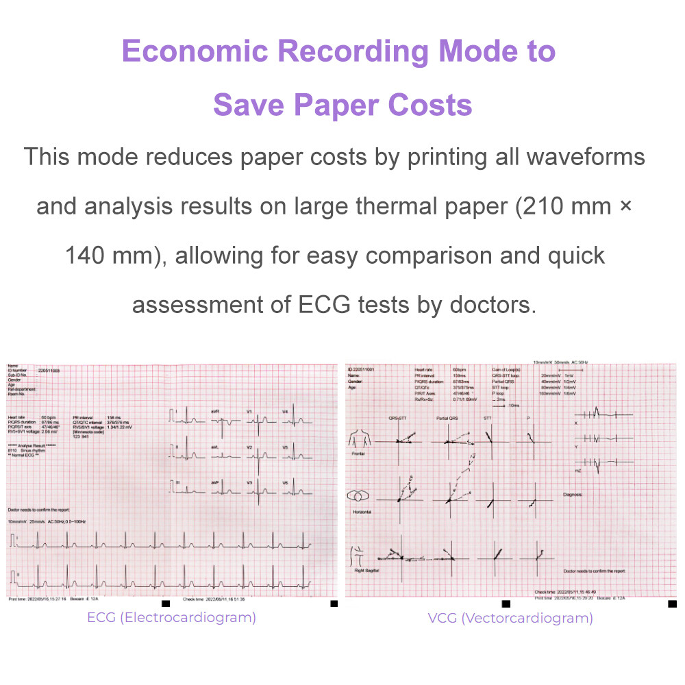 ECG Machine 12 lead/Channel with interpretation for Advisory Diagnosis Printing