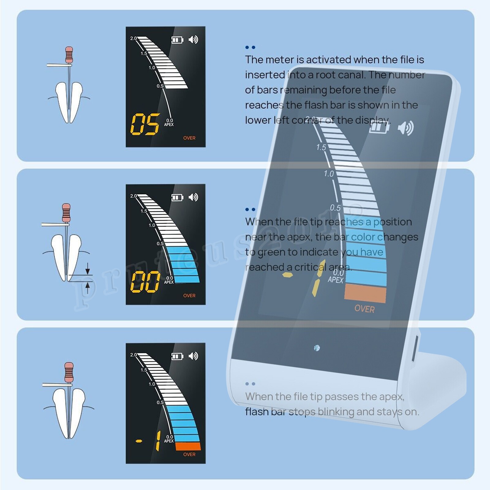 Dental Endodontic Apex Locator Finder Root Canal Measurement