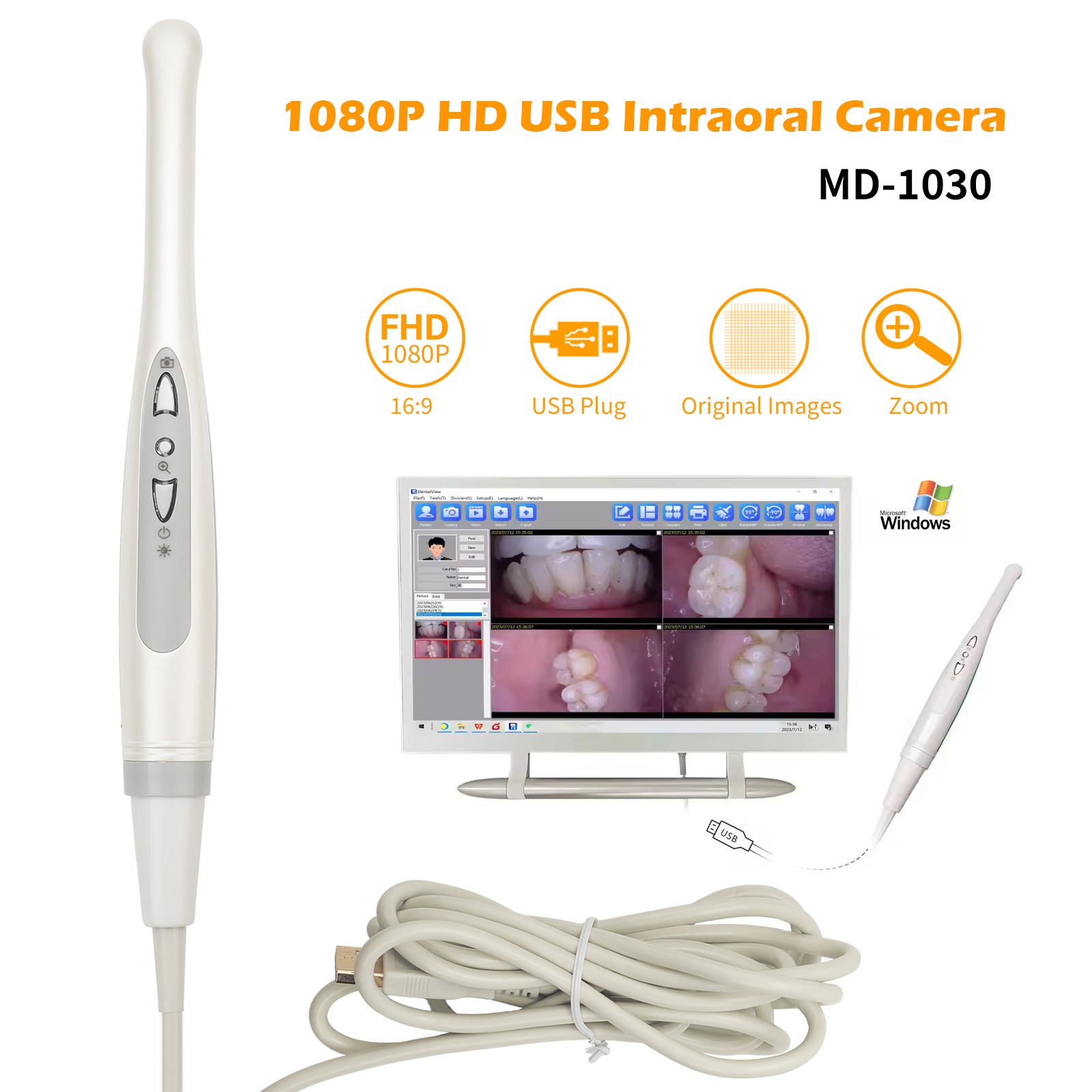 1 Set New USB Intraoral Camera MD1030 1080P 1/3″ HD CMOS COB White Light