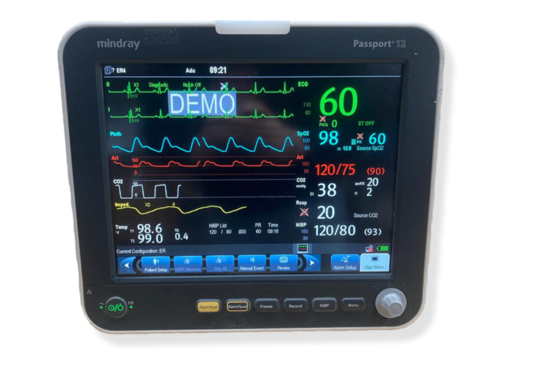 Mindray Passport 12 w/ AG Anesthesia Module – Masimo Spo2 ,NIBP, TEMP, ECG,Gases