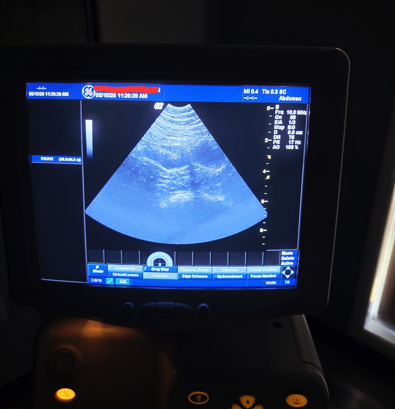 GE Logiq 5 Pro with Probe and Printer Ultrasound System Tested Working
