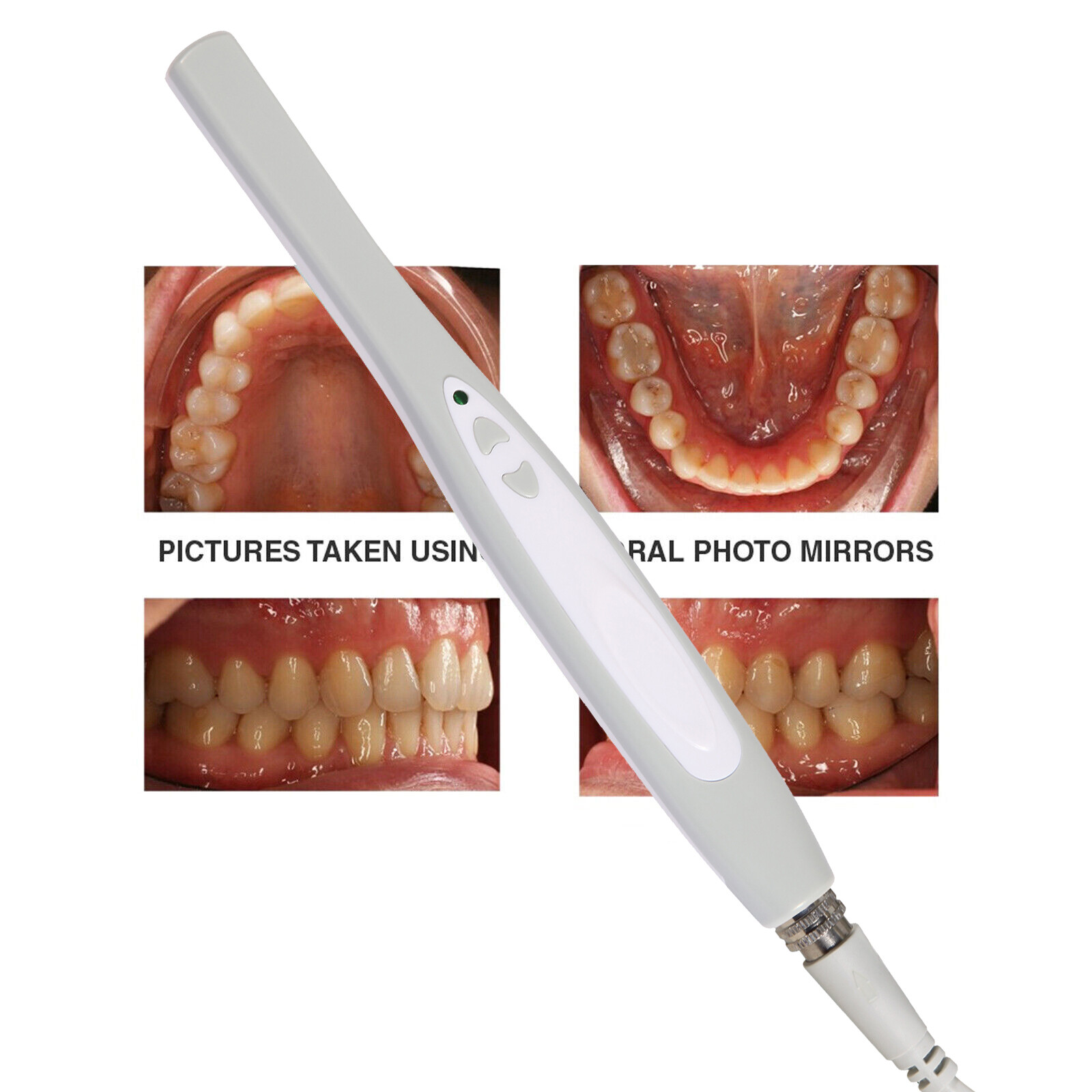 Dental Camera Scanner Intraoral Digital USB Imaging System Oral 6 LED Light MD70