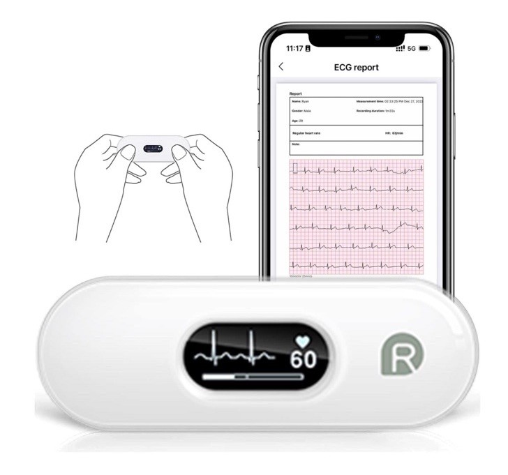 Wellue Checkme DuoEK S Personal Wireless EKG Tracker Device For Wellness Use