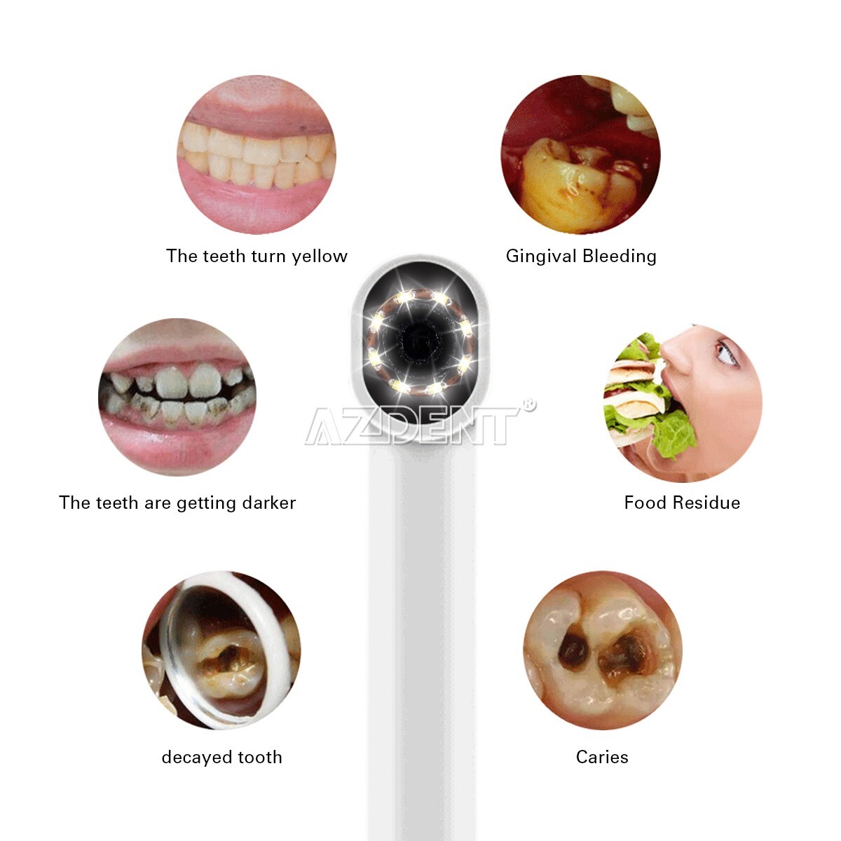 AZDENT Dental HD Intraoral Camera USB Digital Imaging Endoscope 8 LED Light